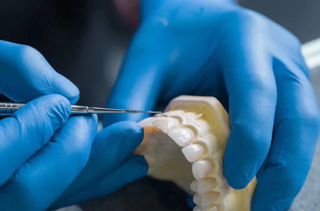Restorative Dentistry: Growing Replacement Teeth via Stem Cells